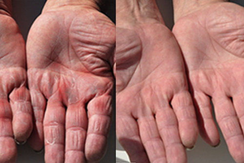 DU IT Tough Hands Intensive Skin Repair 150g. (DUIT) 1