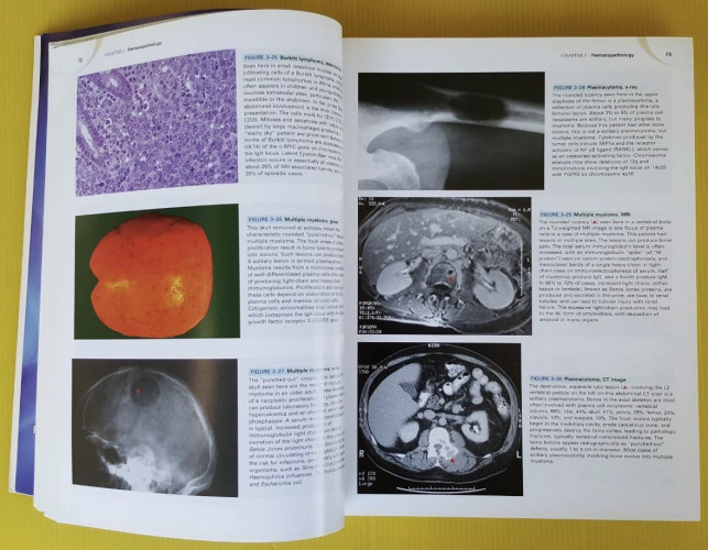 Robbins and cotran atlas of pathology