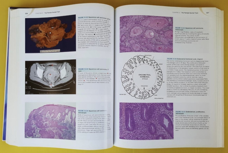 Robbins and cotran atlas of pathology