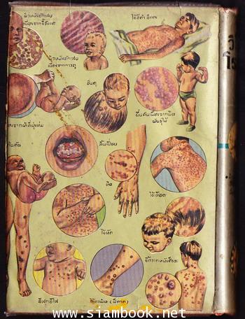 วิธีรักษาโรคเด็ก 1