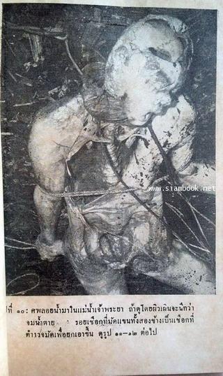 นิติเวชวิทยา 3