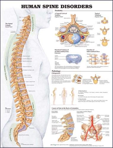Anatomical : ANCAMZ003* โปสเตอร์รูปภาพ Chart Human Spine Disorders